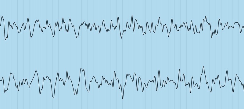 Audio Waveform